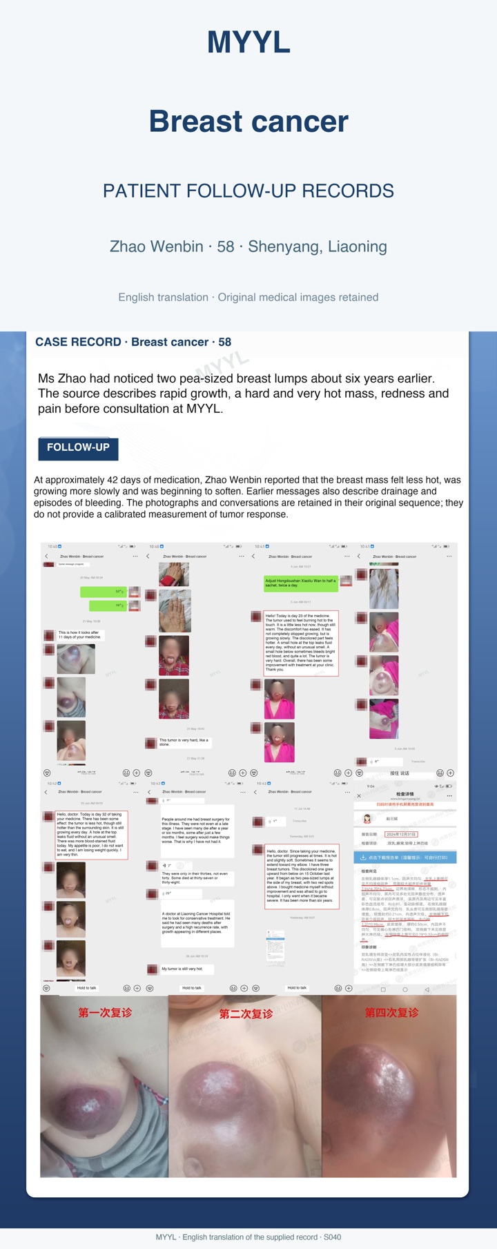 Breast cancer: A later update on the breast wound. English source image 1, with original photographs and clinical records where present.
