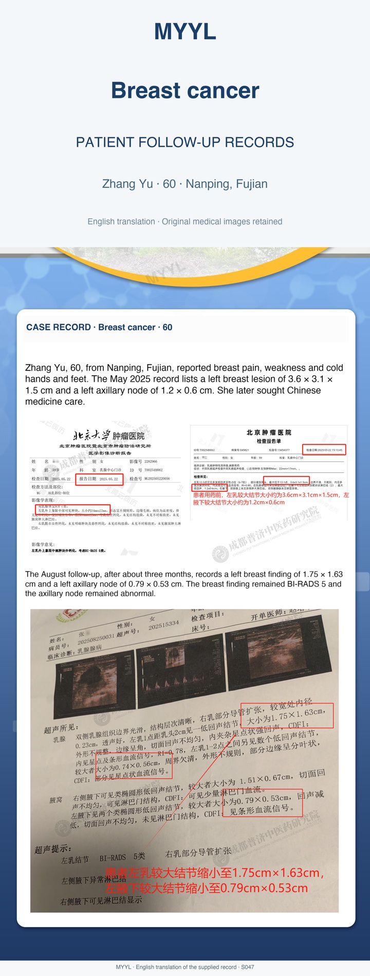 Breast cancer: Breast and axillary findings on follow-up. English source image 1, with original photographs and clinical records where present.