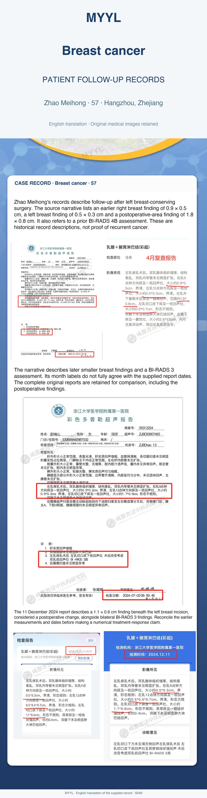 Breast cancer: Follow-up after breast-conserving surgery. English source image 1, with original photographs and clinical records where present.