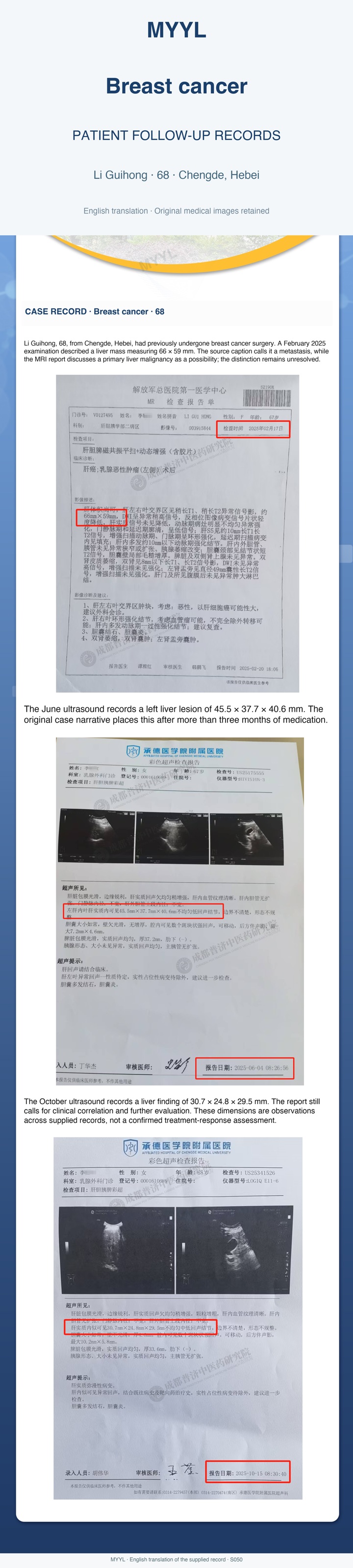 Breast cancer: A liver lesion followed after breast cancer surgery. English source image 1, with original photographs and clinical records where present.