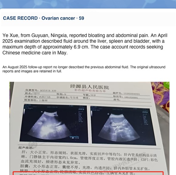 Ovarian cancer — English follow-up screenshot