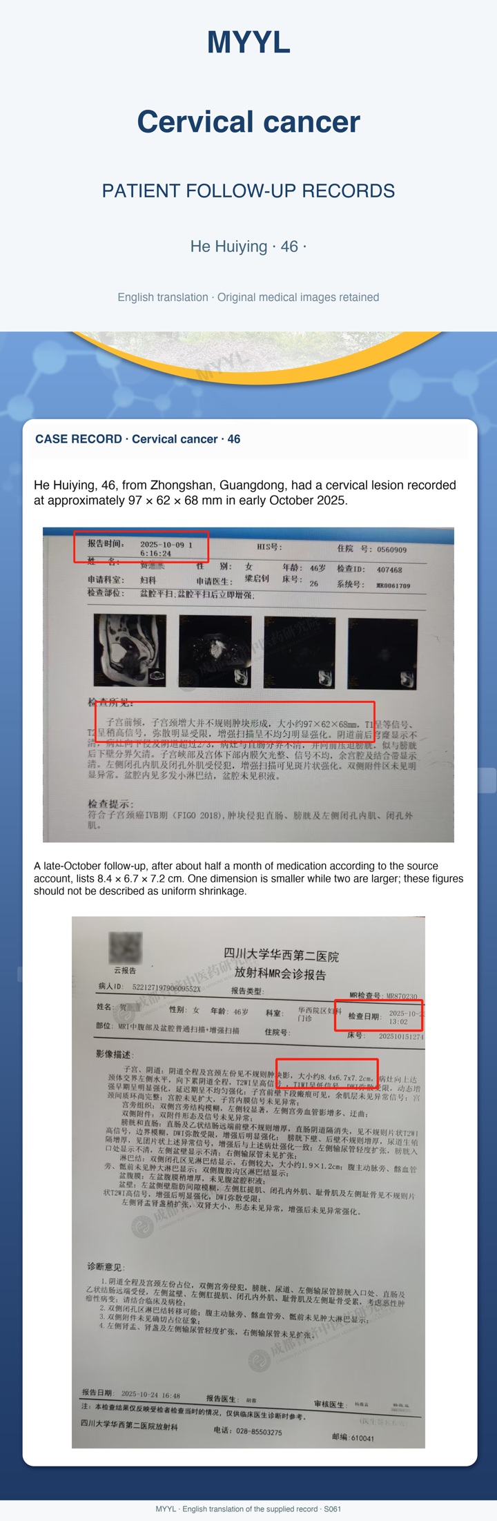 Cervical cancer: Two pelvic MRI descriptions requiring careful comparison. English source image 1, with original photographs and clinical records where present.