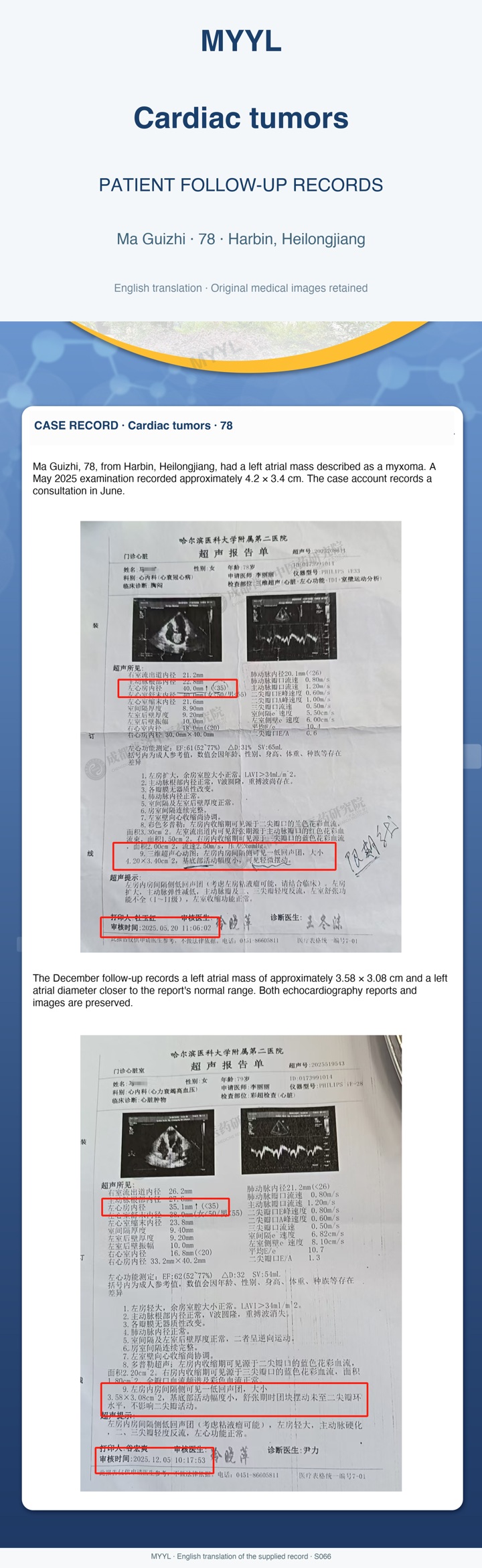 Cardiac tumors: A left atrial mass on serial echocardiography. English source image 1, with original photographs and clinical records where present.