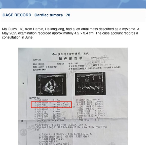 Cardiac tumors — English follow-up screenshot