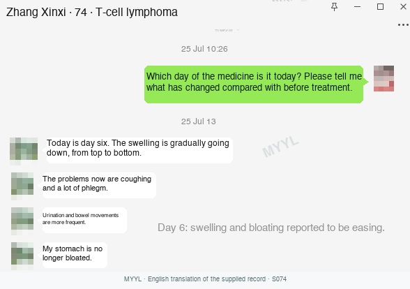 Lymphoma: Swelling eased while cough and sputum continued. English source image 1, with original photographs and clinical records where present.