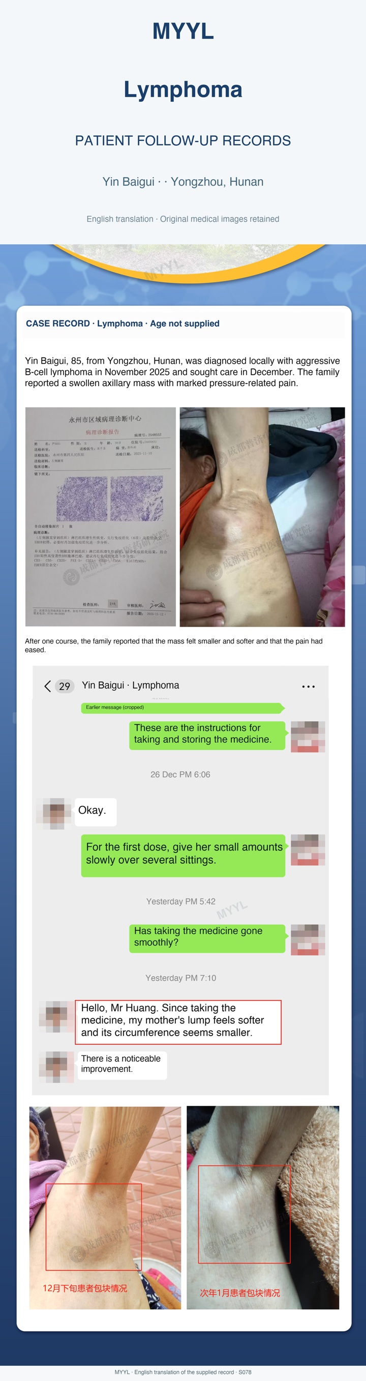 Lymphoma: A family report of a softer axillary lump. English source image 1, with original photographs and clinical records where present.