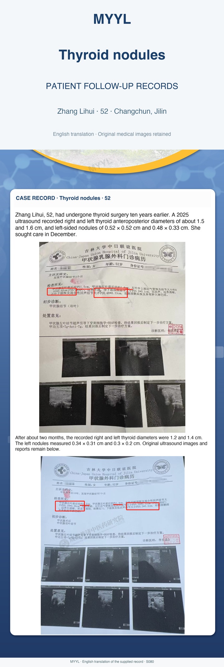 Thyroid nodules: Small thyroid nodules on follow-up. English source image 1, with original photographs and clinical records where present.
