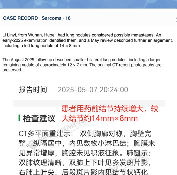Sarcoma — English follow-up screenshot