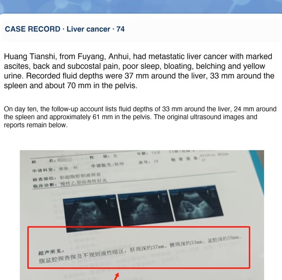 Liver cancer — English follow-up screenshot