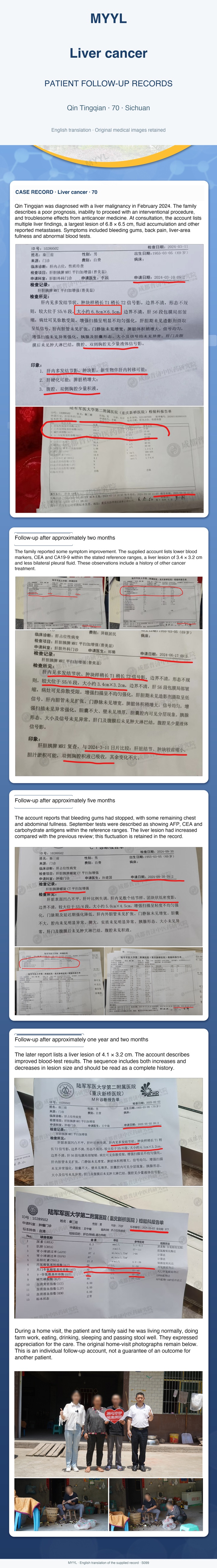 Liver cancer: A liver-lesion record with an intervening increase. English source image 1, with original photographs and clinical records where present.