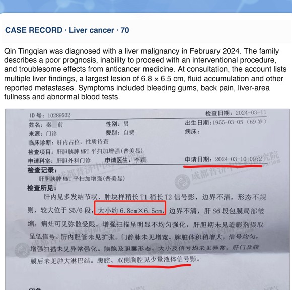 Liver cancer — English follow-up screenshot