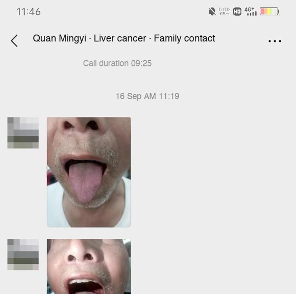 Liver cancer — English follow-up screenshot