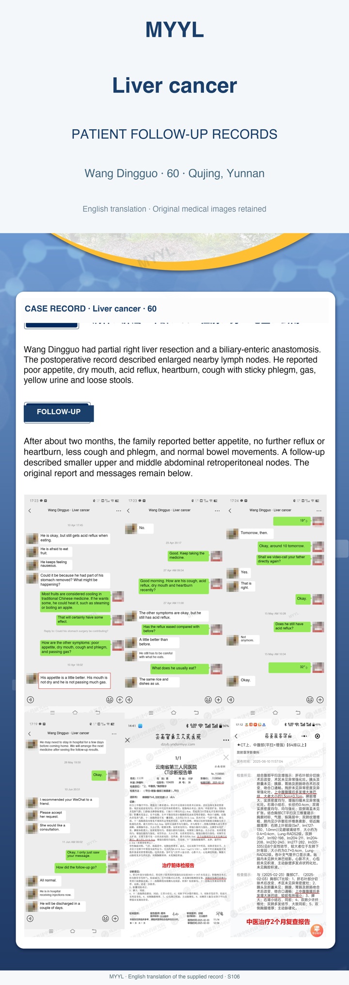 Liver cancer: Postoperative digestive symptoms on follow-up. English source image 1, with original photographs and clinical records where present.