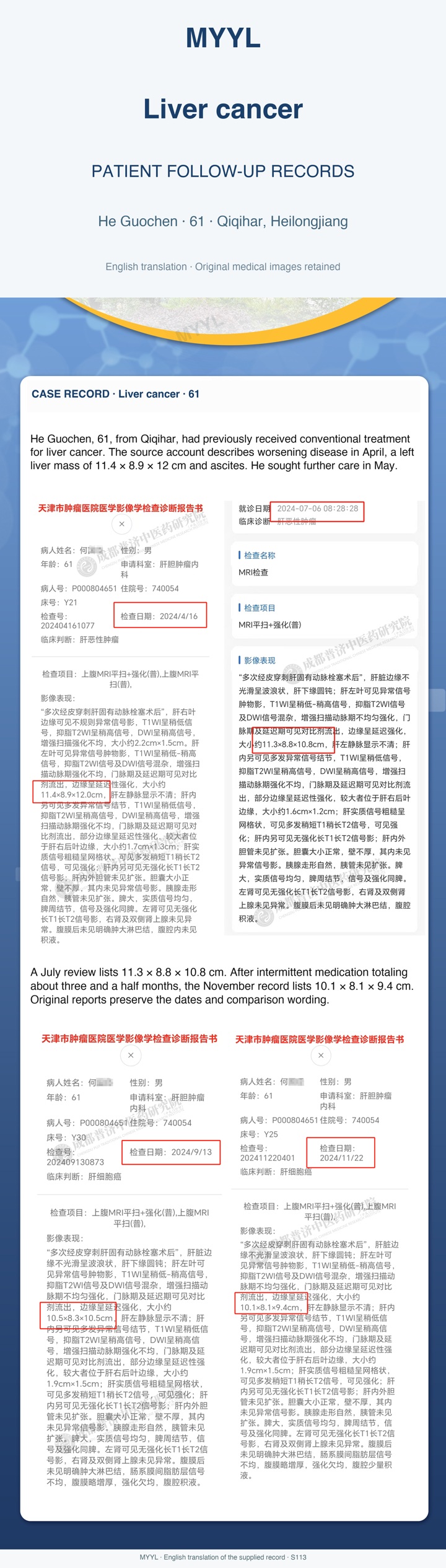 Liver cancer: A main liver mass decreased while disease remained. English source image 1, with original photographs and clinical records where present.
