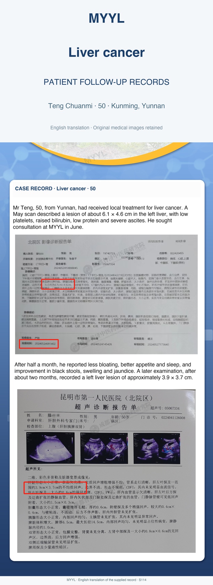 Liver cancer: Digestive symptoms and a liver-lesion follow-up. English source image 1, with original photographs and clinical records where present.