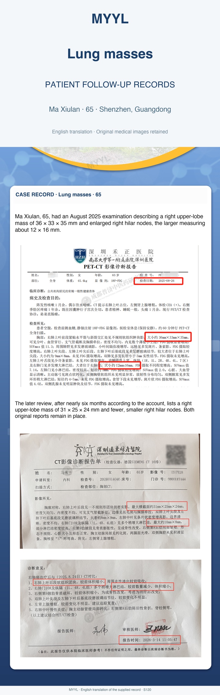 Lung masses: A smaller lung mass with other findings still under follow-up. English source image 1, with original photographs and clinical records where present.