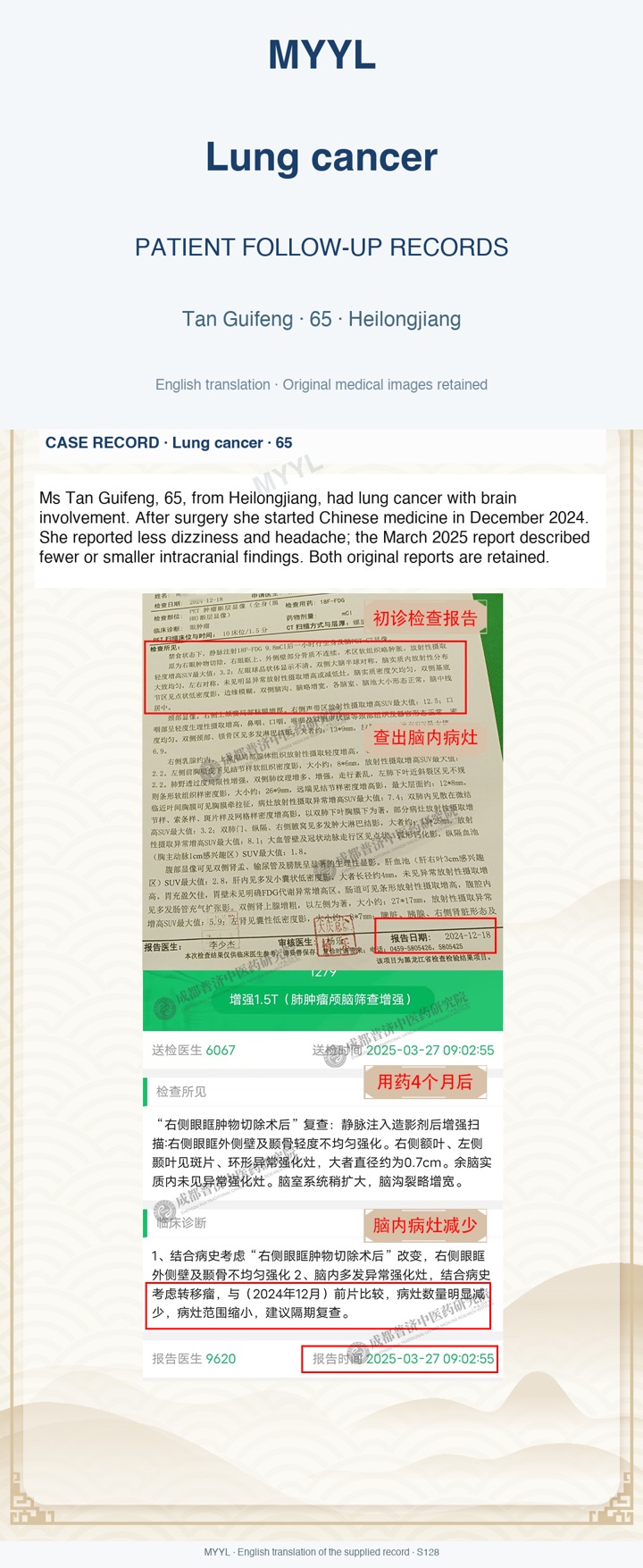 Lung cancer: Fewer brain lesions after a history that includes surgery. English source image 1, with original photographs and clinical records where present.