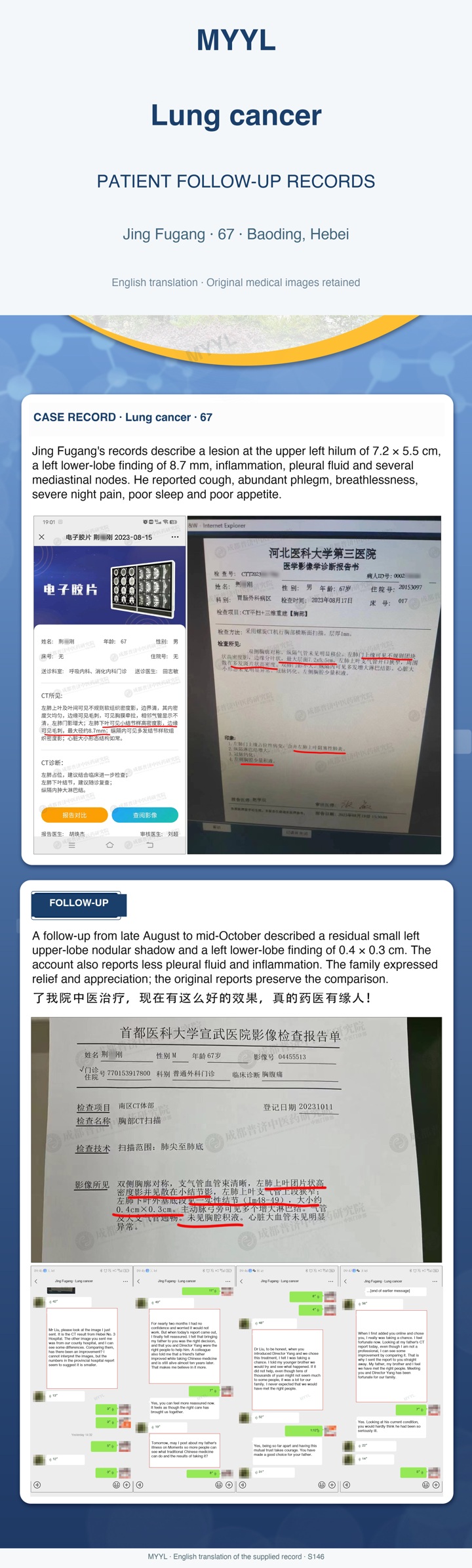 Lung cancer: A lung follow-up with residual lymph nodes. English source image 1, with original photographs and clinical records where present.