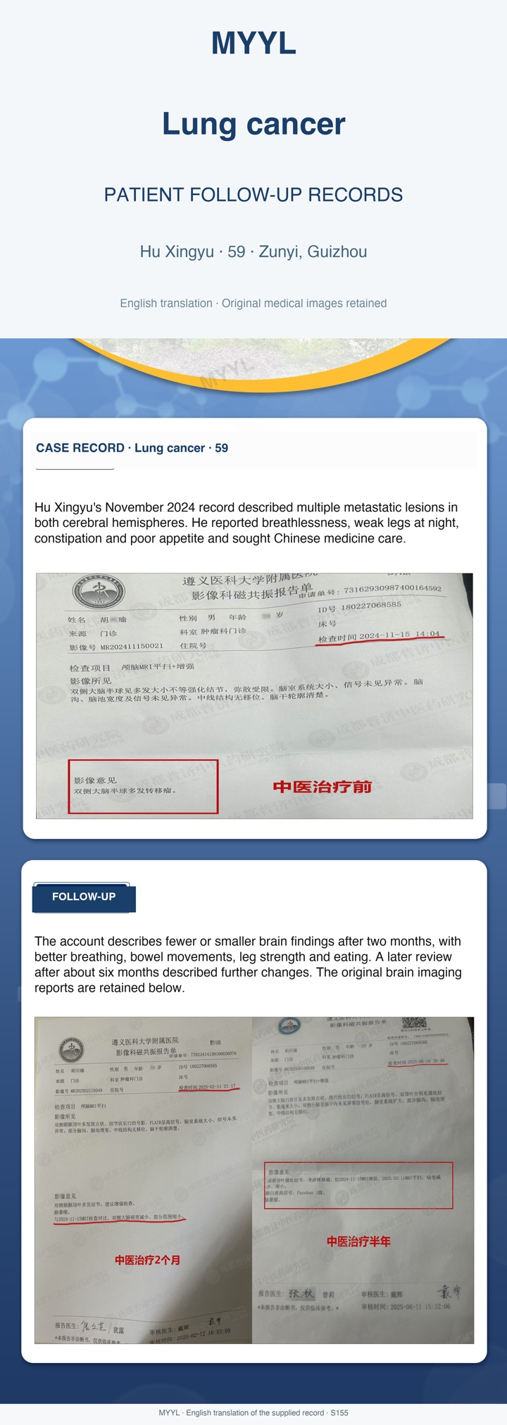 Lung cancer: Serial brain imaging and reported symptom changes. English source image 1, with original photographs and clinical records where present.