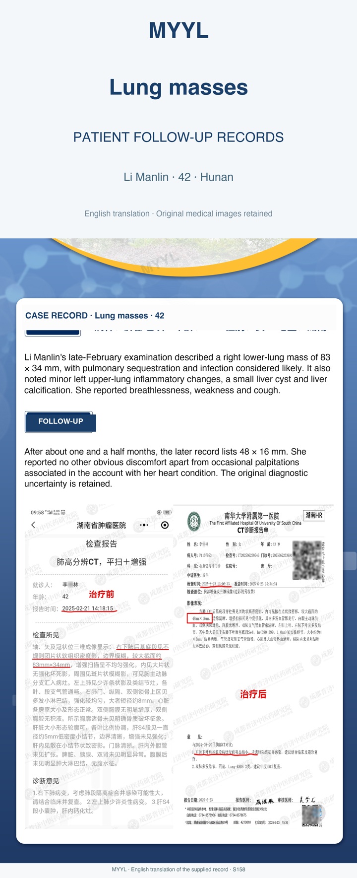 Lung masses: Follow-up of suspected pulmonary sequestration with infection. English source image 1, with original photographs and clinical records where present.