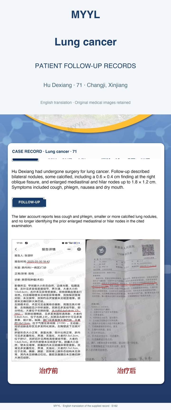 Lung cancer: Postoperative follow-up with persistent thoracic findings. English source image 1, with original photographs and clinical records where present.