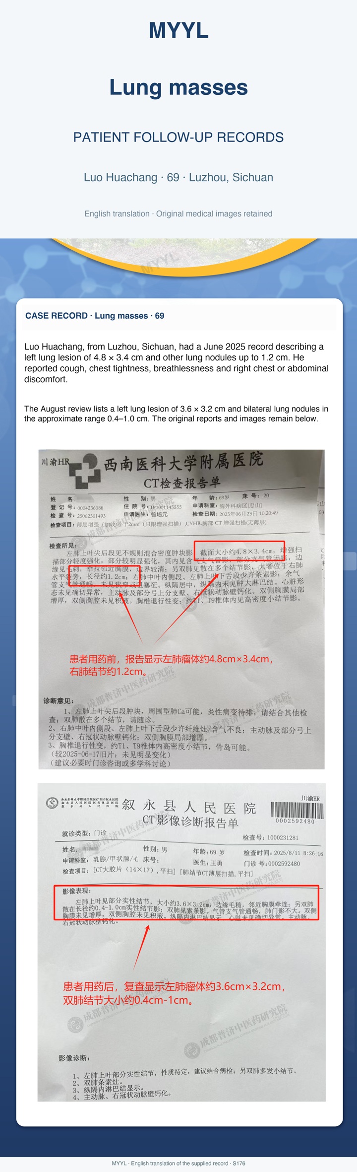 Lung masses: Follow-up of an indeterminate lung lesion. English source image 1, with original photographs and clinical records where present.