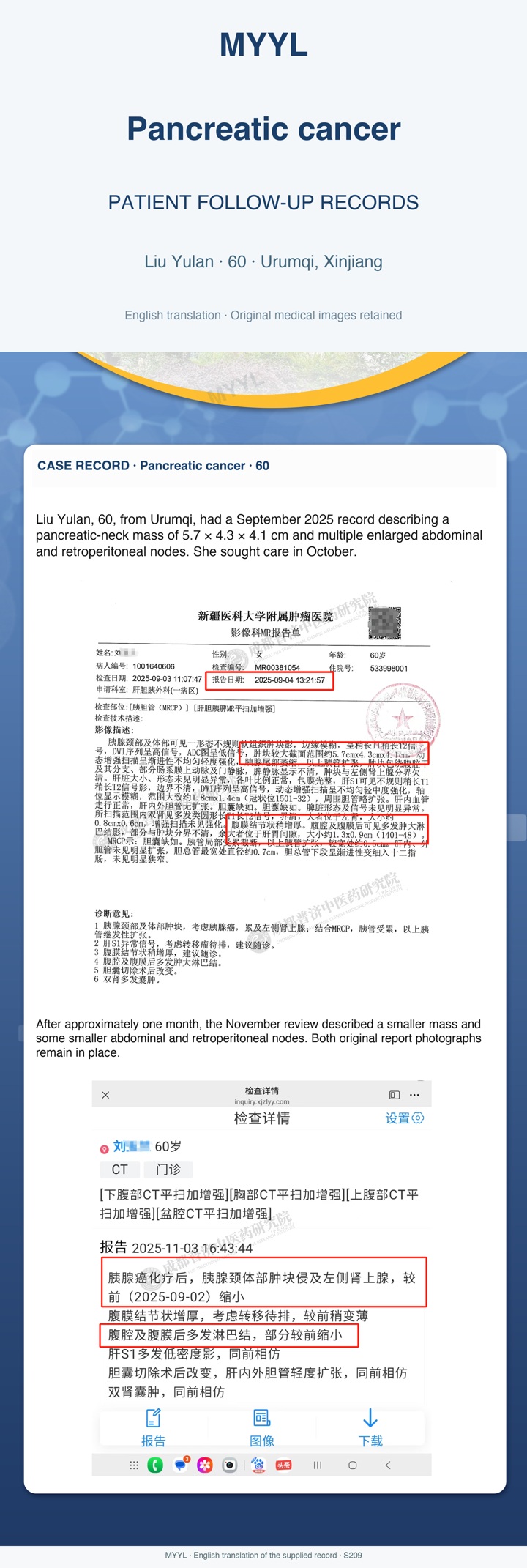 Pancreatic cancer: The earlier pancreatic follow-up after chemotherapy. English source image 1, with original photographs and clinical records where present.