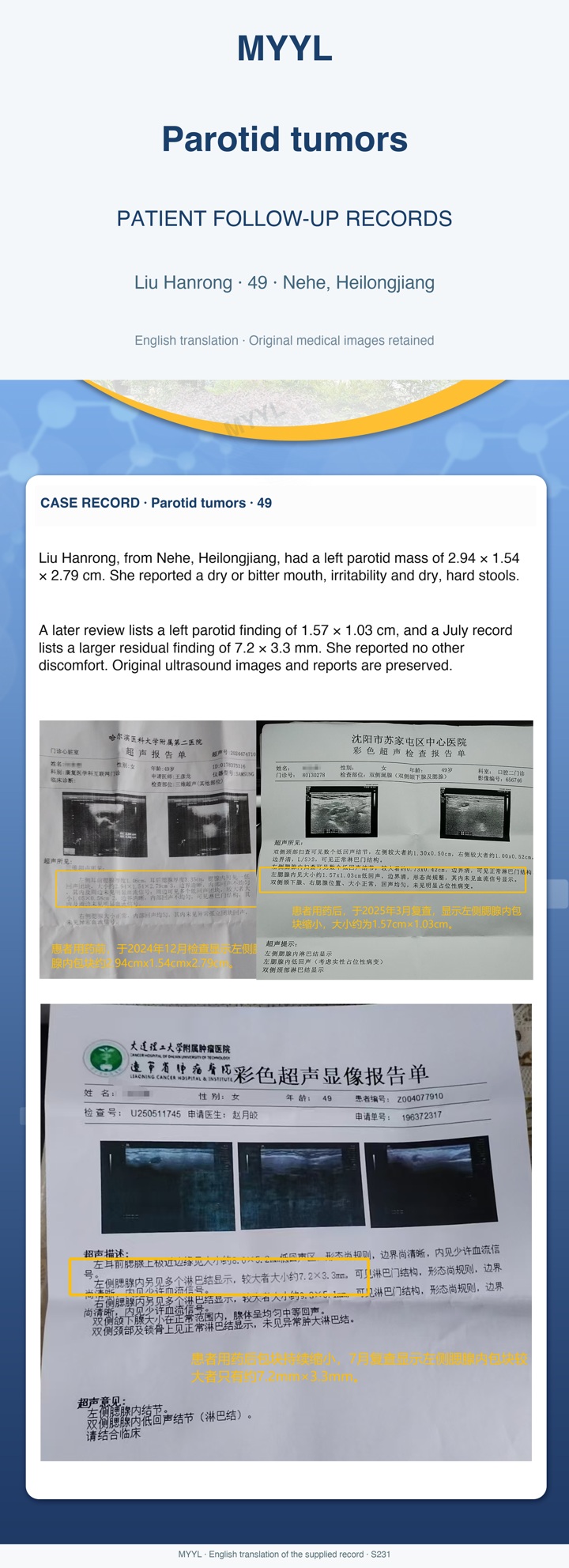 Parotid tumors: Parotid findings across three ultrasound visits. English source image 1, with original photographs and clinical records where present.
