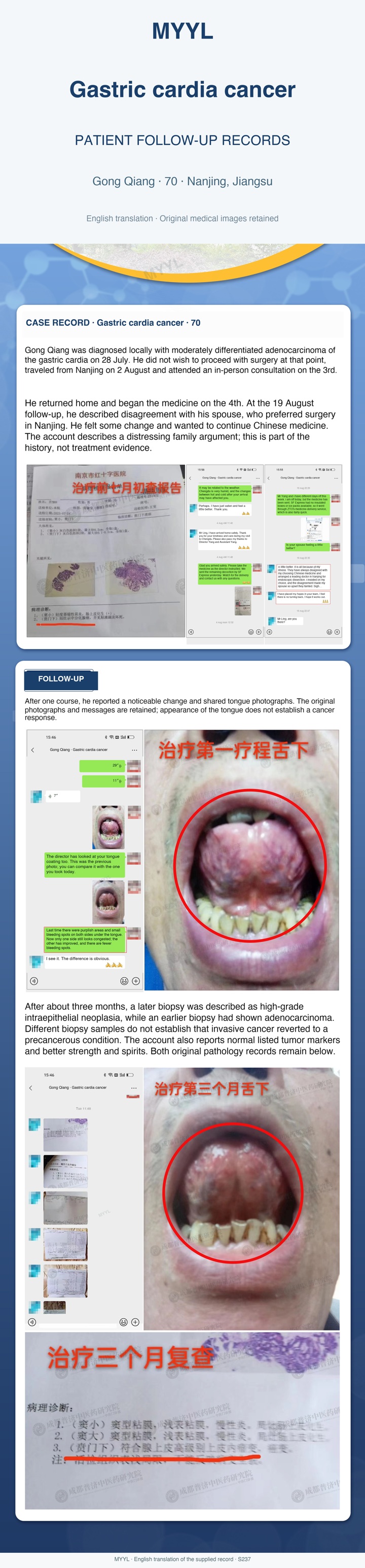 Gastric cardia cancer: Different biopsy descriptions need a pathology review. English source image 1, with original photographs and clinical records where present.