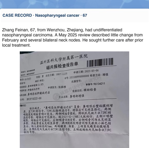 Nasopharyngeal cancer — English follow-up screenshot